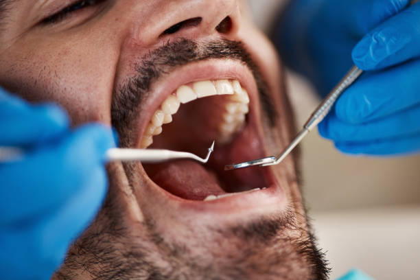 Best Emergency Treatment for Dental Infections or Abscesses in Four Bridges, OH