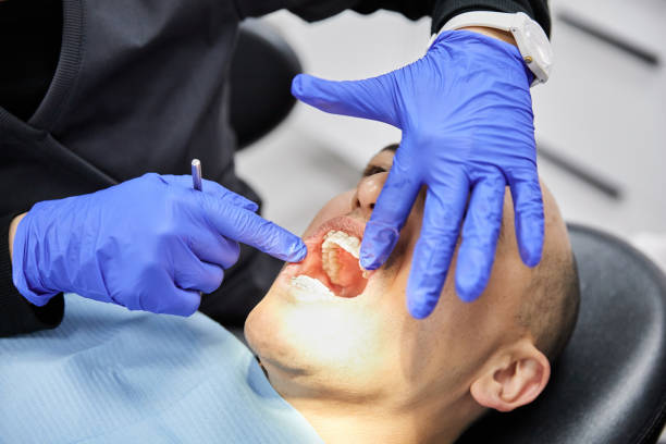 Best Emergency Tooth Extraction in Four Bridges, OH